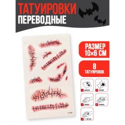 УЧ0675393_бол